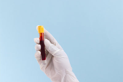 Química sanguínea 3