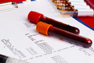 Química sanguínea 6