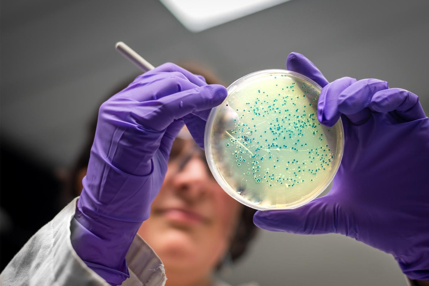 Cultivo bacteriológico