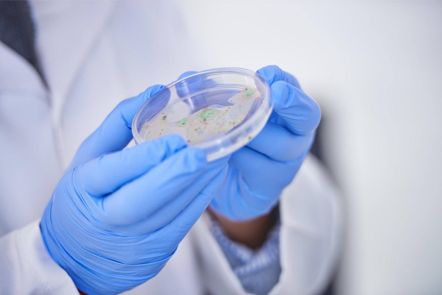 Cultivo bacteriológico (CMI)