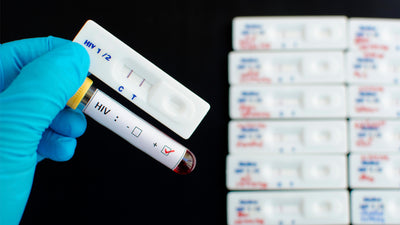 Anticuerpos anti HIV I II