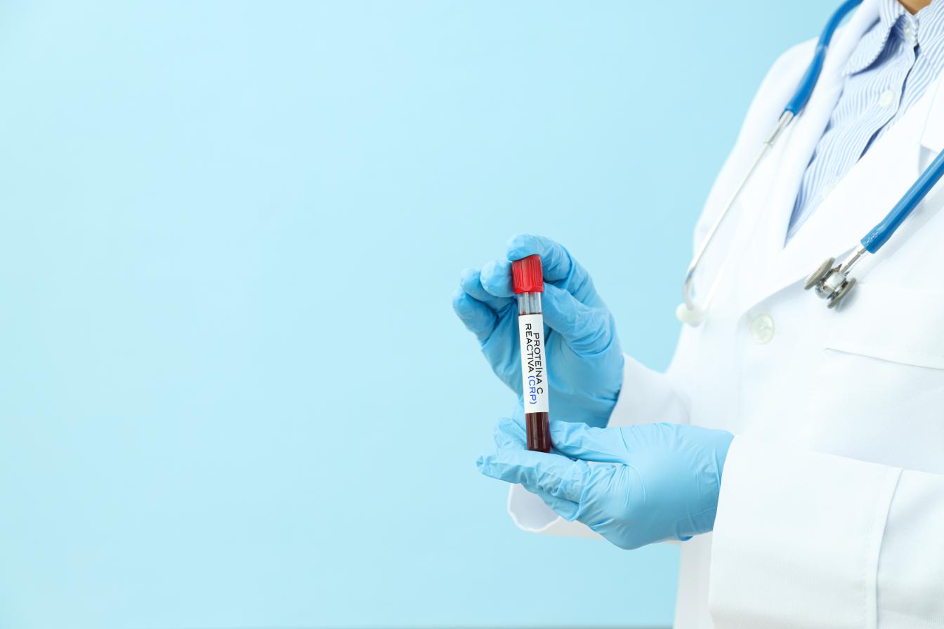 Proteína C reactiva (crp)