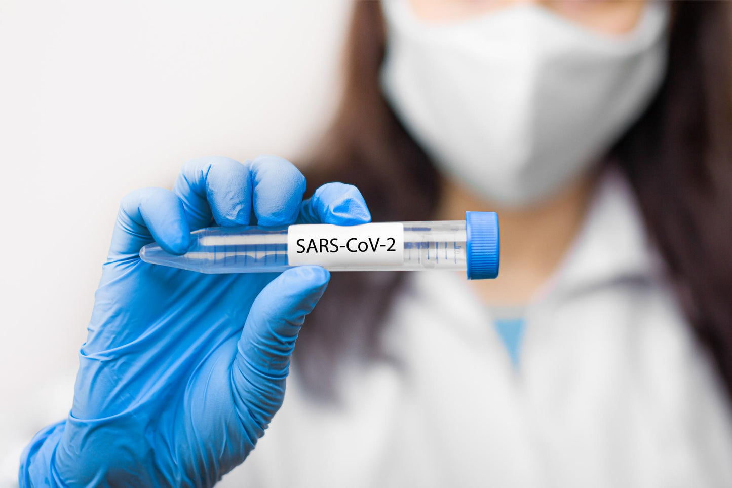 SARS-CoV-2 (COVID-19)